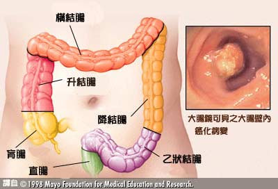 大腸直腸結構